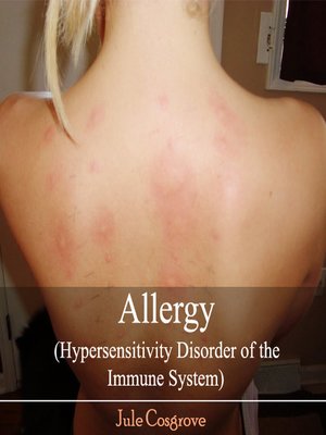 cover image of Allergy